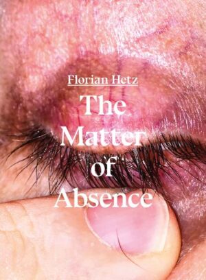 "Through photography, Hetz explores the human body, the beauty in the ugly, and the ugliness in beauty. As his most important sense, he describes seeing since an eye disease runs in his family that might eventually cause him to lose his eyesight. I suppose that knowing you might lose something makes it more precious to you, Hetz explains. The book ""The Matter of Absence"" is Hetz?s first publication. Body parts like in a peep show, caught in an action, caught in a singular moment. Seemingly familiar, and yet very random: Due to the lack of identity, due to the anonymity, it could be the high school crush, the neighbor, the priest, the ex lover, the best friend, or the online flirt. By showing very little of the surrounding, the close-ups offer a wide field of storytelling. The narrative happens rather in the head than on the photo. What leads to that particular moment becomes equally important as the moment itself. The absence of identity in times of selfies. Designer Stefano Pilati puts it like this: ""In his authenticity, Hetz?s talent maniacally explores the moment between the photographer-as artist, witness, obsessive-and the subject. He interprets the body as a quintessential sex object through simple, domestic gestures, producing a body of work that is far removed from the spirit of entertainment and staging in current forms of social-media visualizations."" A stunning, unique debut. "