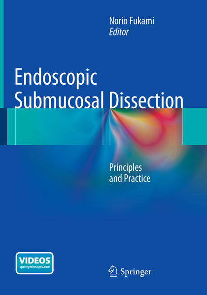 Endoscopic Submucosal Dissection | Gay Books & News
