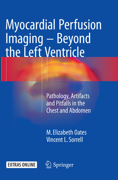Myocardial Perfusion Imaging - Beyond the Left Ventricle | Gay Books & News